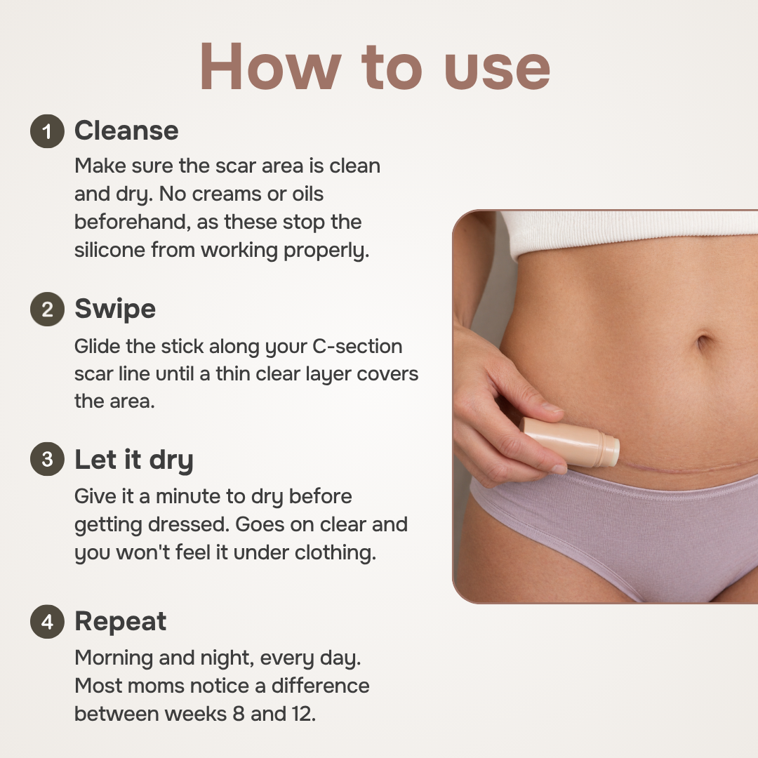 C-Section Scar Therapy Stick